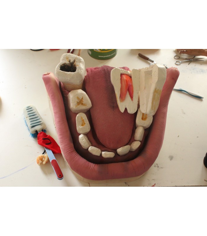 DENTADURA DESMONTABLE